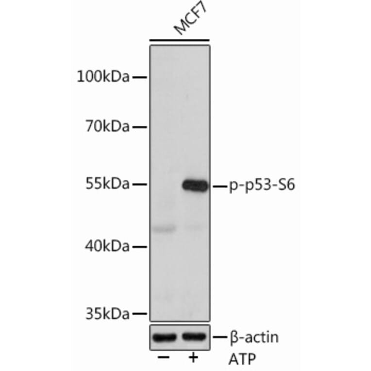 Western Blot - Anti-p53 (phospho Ser6) Antibody (A308225) - Antibodies.com