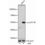 Western Blot - Anti-p53 (phospho Ser6) Antibody (A308225) - Antibodies.com
