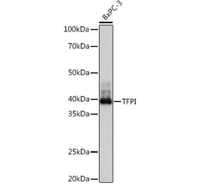 Western Blot - Anti-TFPI Antibody [ARC1154] (A308226) - Antibodies.com