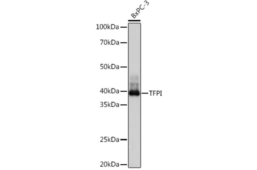 Western Blot - Anti-TFPI Antibody [ARC1154] (A308226) - Antibodies.com