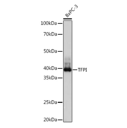 Western Blot - Anti-TFPI Antibody [ARC1154] (A308226) - Antibodies.com