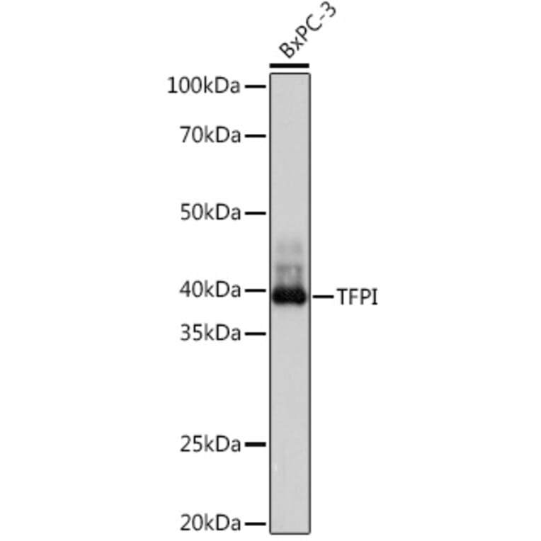 Western Blot - Anti-TFPI Antibody [ARC1154] (A308226) - Antibodies.com