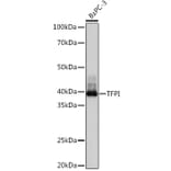 Western Blot - Anti-TFPI Antibody [ARC1154] (A308226) - Antibodies.com