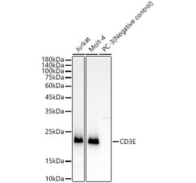 Western Blot - Anti-CD3 epsilon Antibody [ARC51750] (A308227) - Antibodies.com