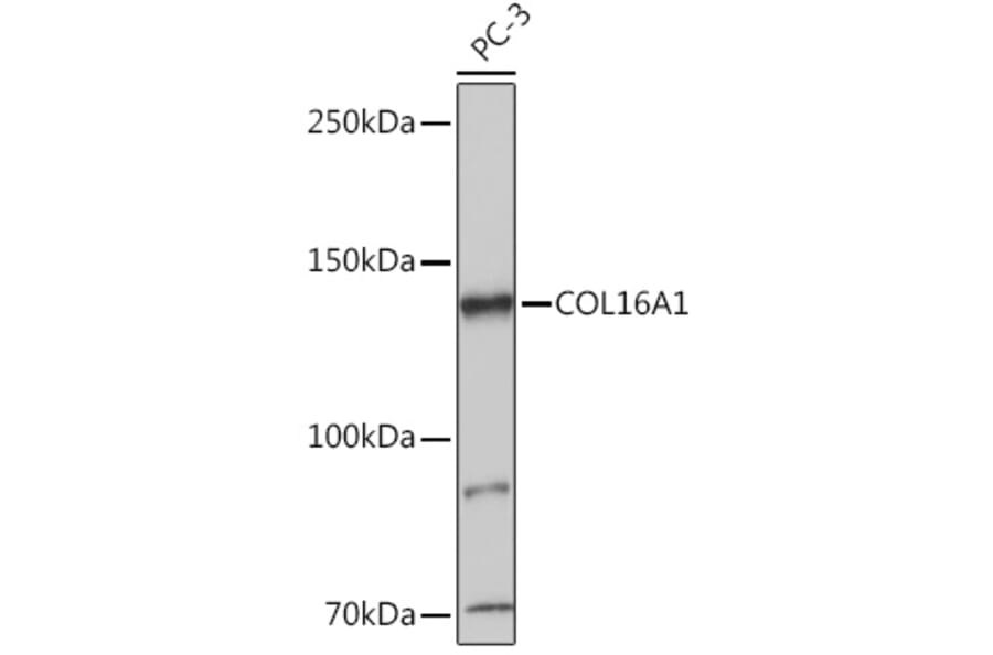 Western Blot - Anti-COL16A1 Antibody (A308228) - Antibodies.com
