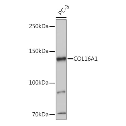 Western Blot - Anti-COL16A1 Antibody (A308228) - Antibodies.com