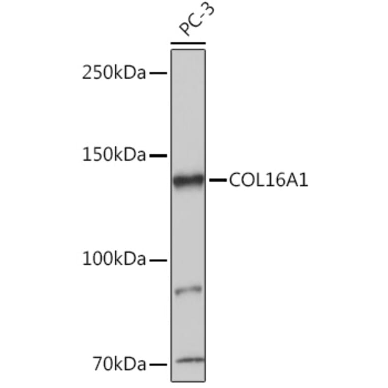 Western Blot - Anti-COL16A1 Antibody (A308228) - Antibodies.com
