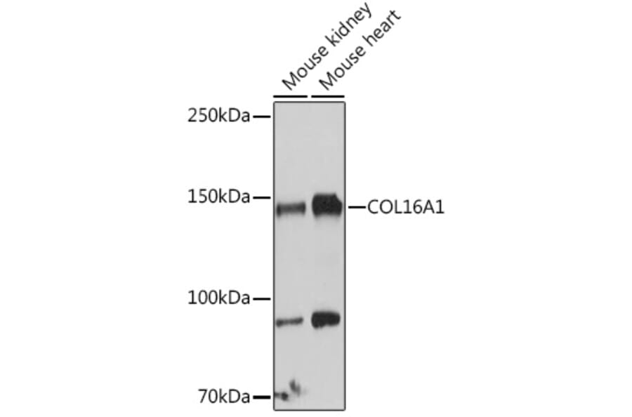 Western Blot - Anti-COL16A1 Antibody (A308228) - Antibodies.com