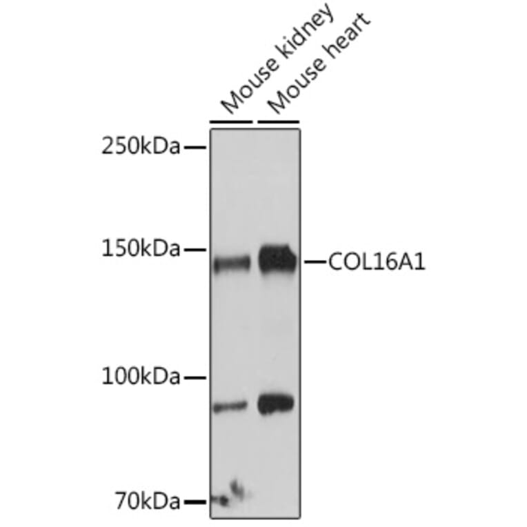 Western Blot - Anti-COL16A1 Antibody (A308228) - Antibodies.com