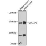 Western Blot - Anti-COL16A1 Antibody (A308228) - Antibodies.com
