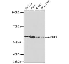 Western Blot - Anti-AMHR2 Antibody [ARC1313] (A308229) - Antibodies.com