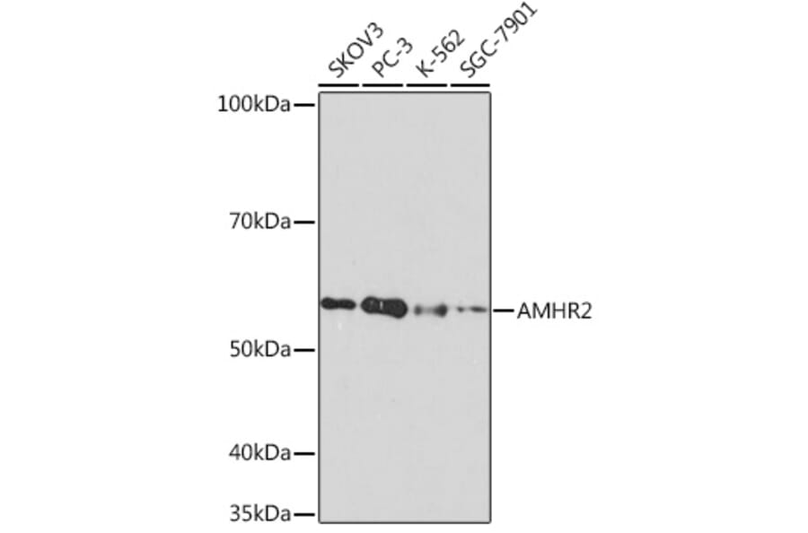 Western Blot - Anti-AMHR2 Antibody [ARC1313] (A308229) - Antibodies.com