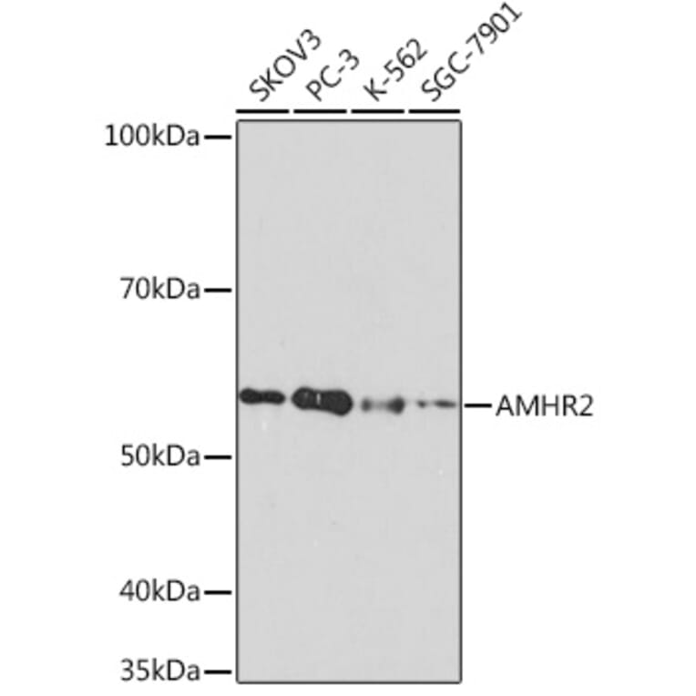 Western Blot - Anti-AMHR2 Antibody [ARC1313] (A308229) - Antibodies.com