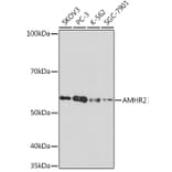 Western Blot - Anti-AMHR2 Antibody [ARC1313] (A308229) - Antibodies.com