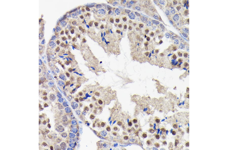Immunohistochemistry - Anti-PI 3 Kinase p85 beta Antibody [ARC0287] (A308231) - Antibodies.com