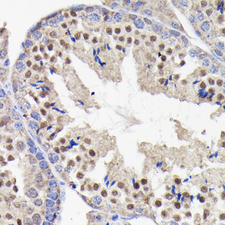 Immunohistochemistry - Anti-PI 3 Kinase p85 beta Antibody [ARC0287] (A308231) - Antibodies.com