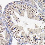 Immunohistochemistry - Anti-PI 3 Kinase p85 beta Antibody [ARC0287] (A308231) - Antibodies.com