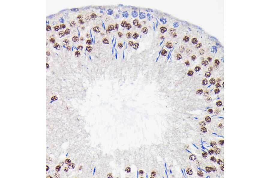 Immunohistochemistry - Anti-PI 3 Kinase p85 beta Antibody [ARC0287] (A308231) - Antibodies.com