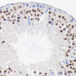 Immunohistochemistry - Anti-PI 3 Kinase p85 beta Antibody [ARC0287] (A308231) - Antibodies.com