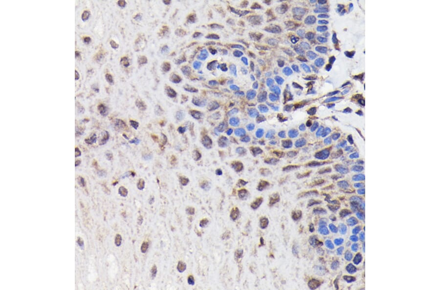 Immunohistochemistry - Anti-PI 3 Kinase p85 beta Antibody [ARC0287] (A308231) - Antibodies.com