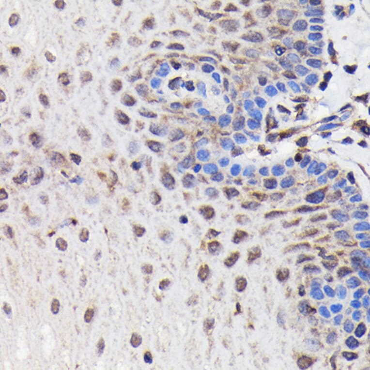 Immunohistochemistry - Anti-PI 3 Kinase p85 beta Antibody [ARC0287] (A308231) - Antibodies.com