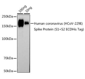 Western Blot - Anti-Human Coronavirus Spike glycoprotein Antibody (A308232) - Antibodies.com