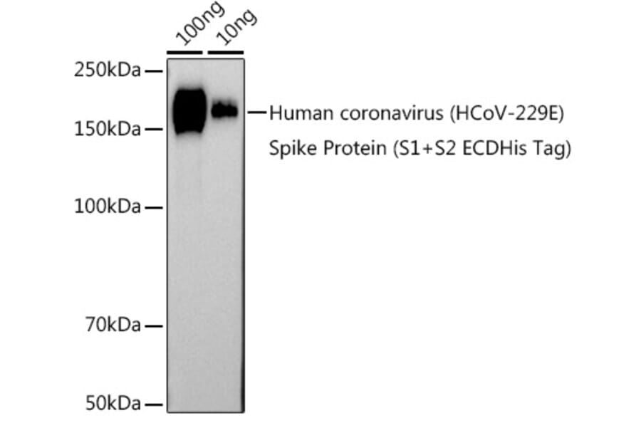 Western Blot - Anti-Human Coronavirus Spike glycoprotein Antibody (A308232) - Antibodies.com