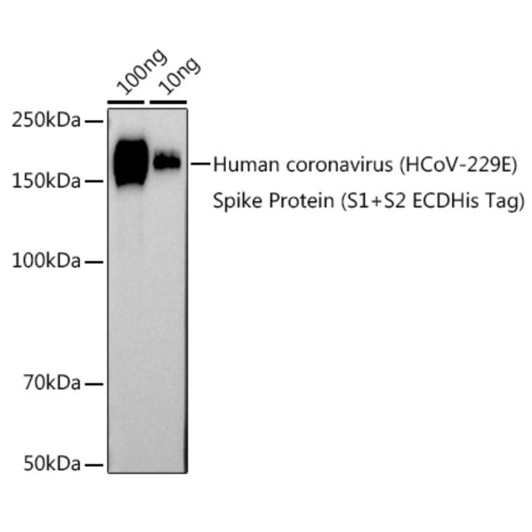 Western Blot - Anti-Human Coronavirus Spike glycoprotein Antibody (A308232) - Antibodies.com
