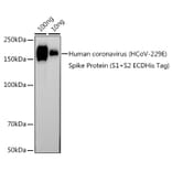 Western Blot - Anti-Human Coronavirus Spike glycoprotein Antibody (A308232) - Antibodies.com