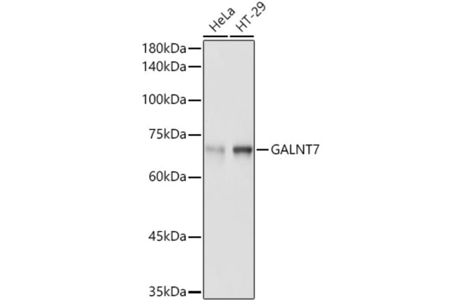 Western Blot - Anti-GALNT7 Antibody (A308233) - Antibodies.com