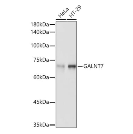 Western Blot - Anti-GALNT7 Antibody (A308233) - Antibodies.com