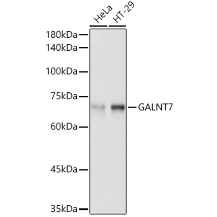 Western Blot - Anti-GALNT7 Antibody (A308233) - Antibodies.com