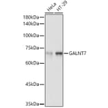 Western Blot - Anti-GALNT7 Antibody (A308233) - Antibodies.com