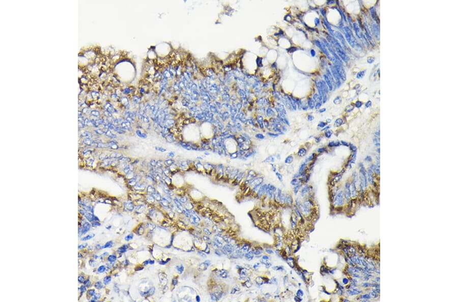 Immunohistochemistry - Anti-GALNT7 Antibody (A308233) - Antibodies.com