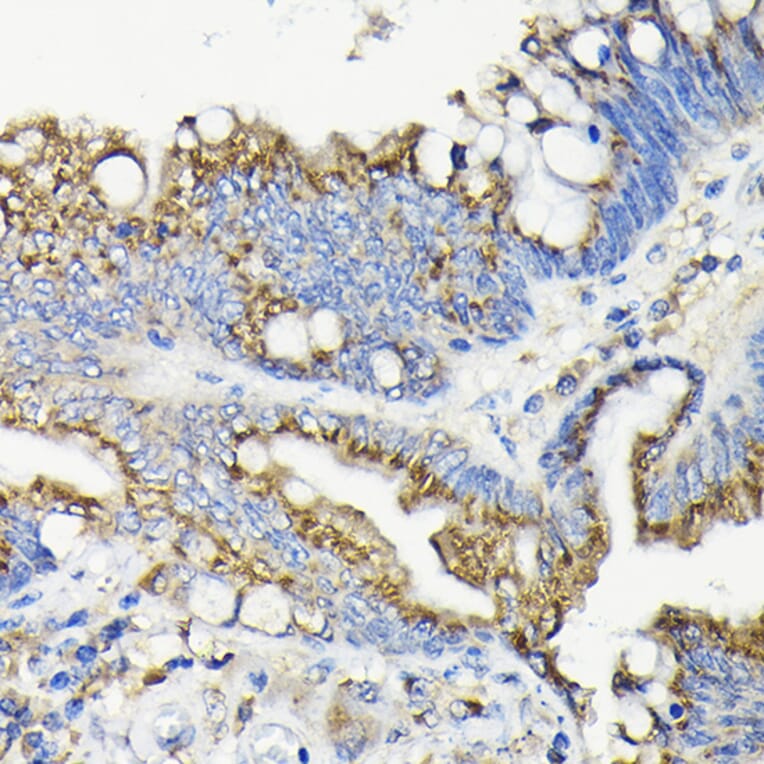Immunohistochemistry - Anti-GALNT7 Antibody (A308233) - Antibodies.com
