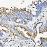 Immunohistochemistry - Anti-GALNT7 Antibody (A308233) - Antibodies.com