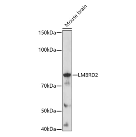 Western Blot - Anti-LMBRD2 Antibody (A308234) - Antibodies.com