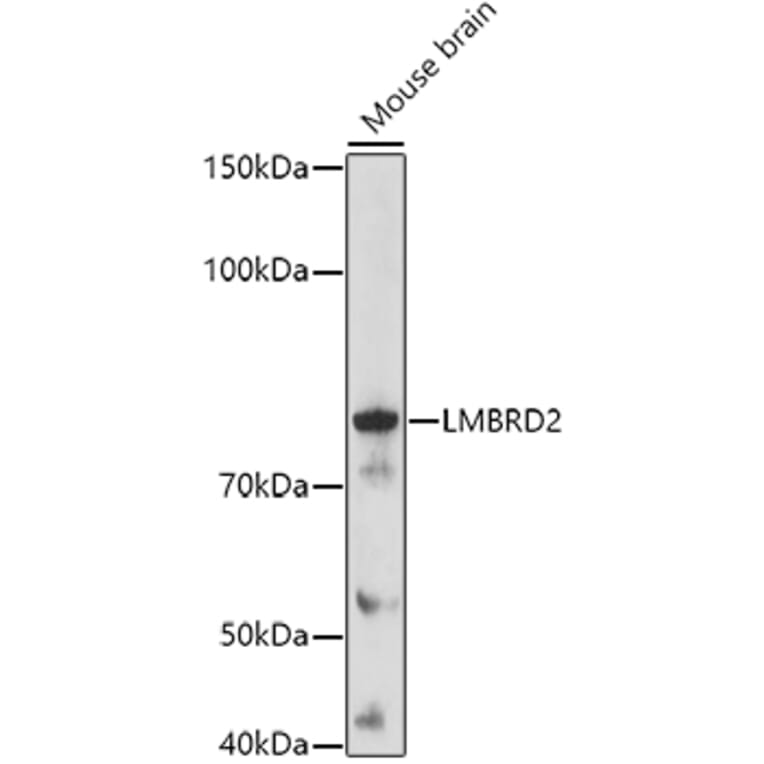 Western Blot - Anti-LMBRD2 Antibody (A308234) - Antibodies.com