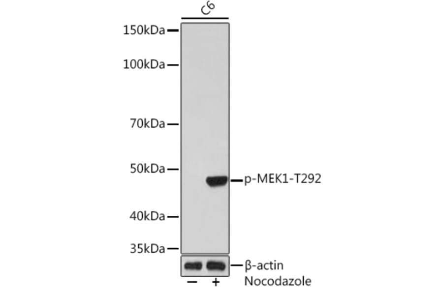 Western Blot - Anti-MEK1 (phospho Thr292) Antibody [ARC1566] (A308235) - Antibodies.com