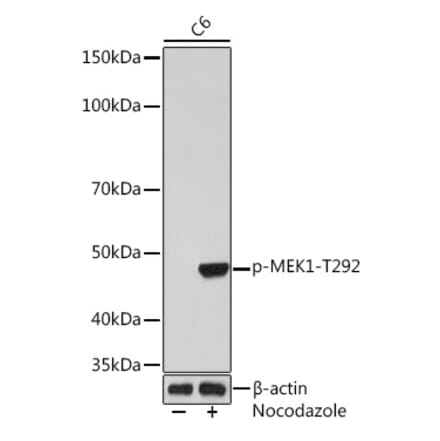 Western Blot - Anti-MEK1 (phospho Thr292) Antibody [ARC1566] (A308235) - Antibodies.com
