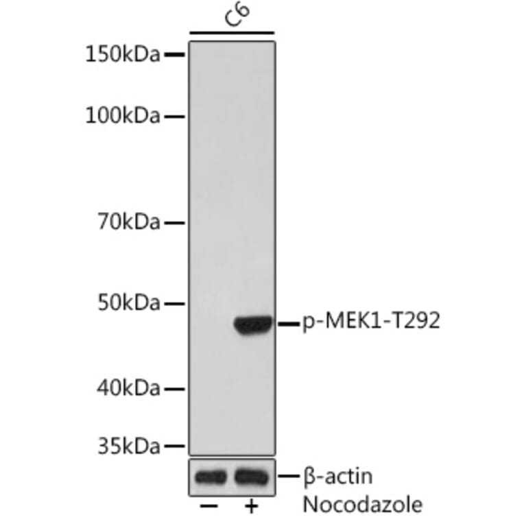 Western Blot - Anti-MEK1 (phospho Thr292) Antibody [ARC1566] (A308235) - Antibodies.com