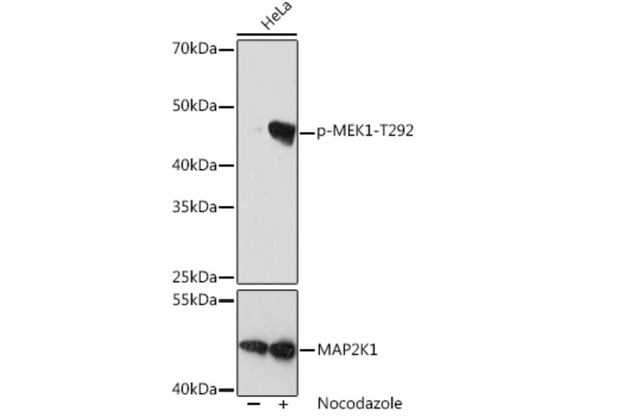 Western Blot - Anti-MEK1 (phospho Thr292) Antibody [ARC1566] (A308235) - Antibodies.com