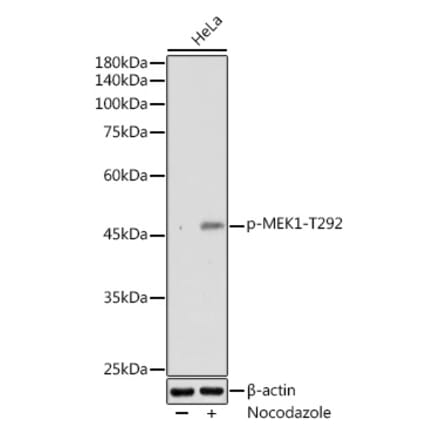 Western Blot - Anti-MEK1 (phospho Thr292) Antibody (A308236) - Antibodies.com