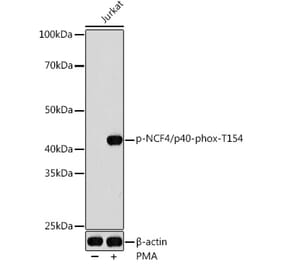 Western Blot - Anti-p40-phox (phospho Thr154) Antibody (A308237) - Antibodies.com