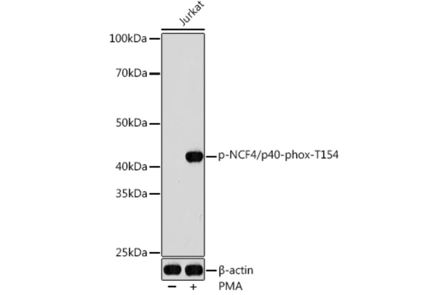 Western Blot - Anti-p40-phox (phospho Thr154) Antibody (A308237) - Antibodies.com