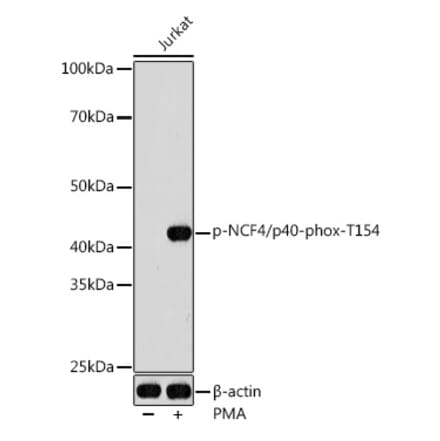 Western Blot - Anti-p40-phox (phospho Thr154) Antibody (A308237) - Antibodies.com