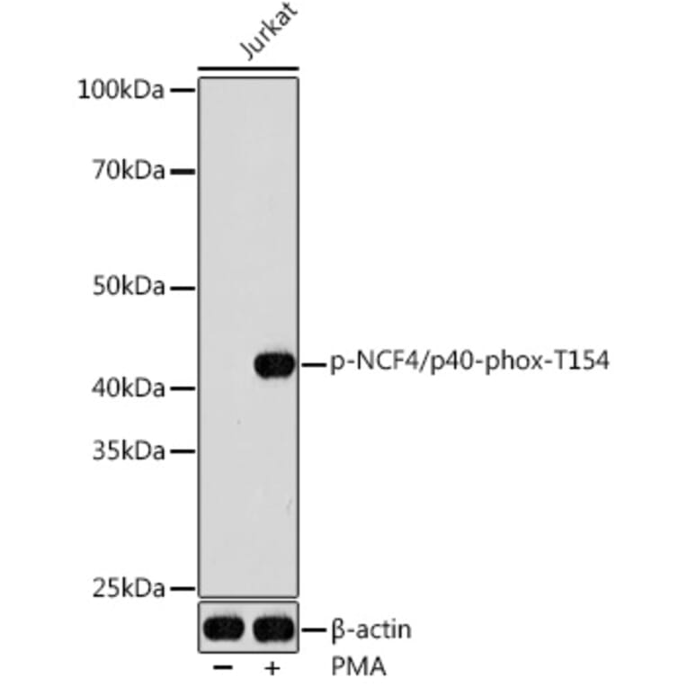 Western Blot - Anti-p40-phox (phospho Thr154) Antibody (A308237) - Antibodies.com