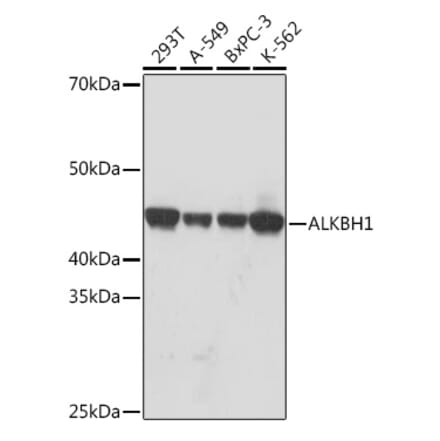 Western Blot - Anti-ALKBH1 Antibody [ARC1481] (A308238) - Antibodies.com