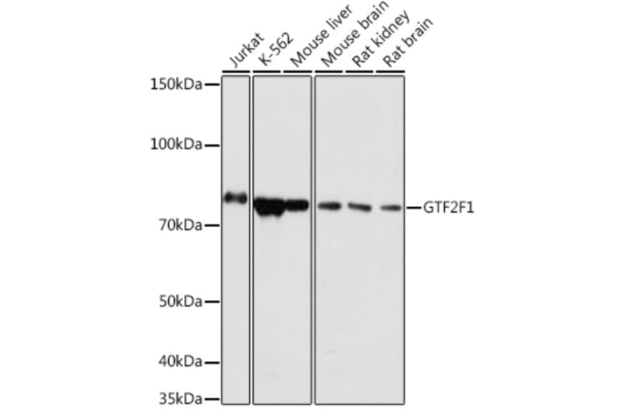 Western Blot - Anti-TFIIF Antibody (A308239) - Antibodies.com
