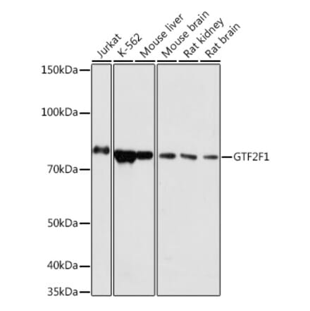 Western Blot - Anti-TFIIF Antibody (A308239) - Antibodies.com